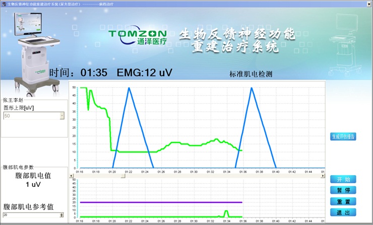 盆底康复治疗仪评估盆底肌流程