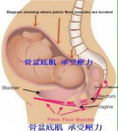 产后盆底康复治疗开始后，出现阴道出血怎么破？