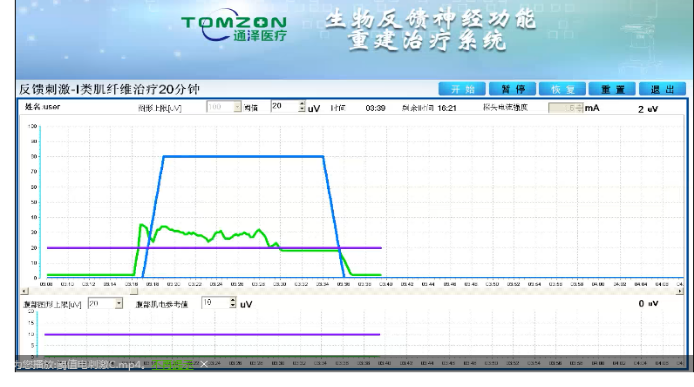 盆底康复治疗怎么做？盆底康复治疗肌电生物反馈治疗仪的机理是什么？