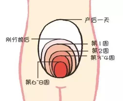 产后康复，什么叫子宫复旧不良？