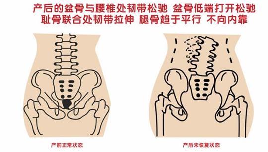 上百家产后修复中心店家告诉您产后盆底肌怎么修复