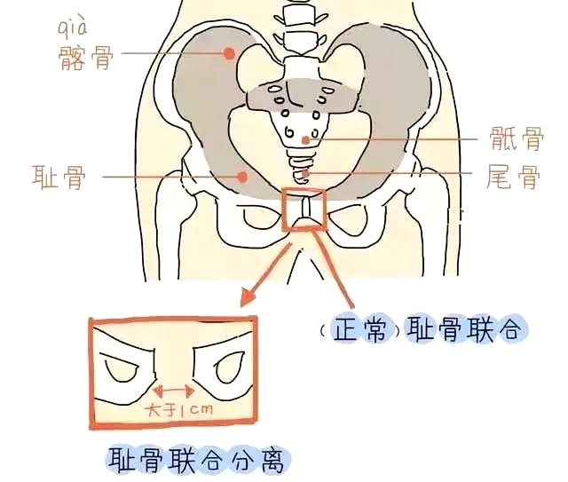 产后康复治疗仪乳房按摩对剖宫产产妇乳汁分泌的影响