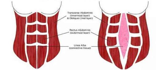 热门话题之产后腹直肌分离如何康复，腹直肌修复仪器功不可没