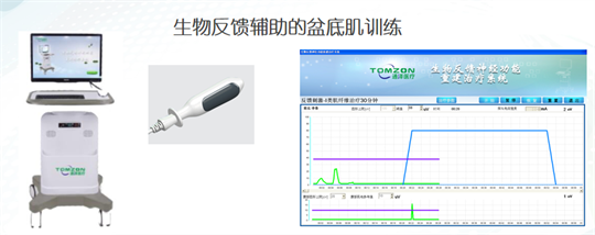 产后修复|盆底肌肉功能电刺激有什么作用？生物反馈呢？