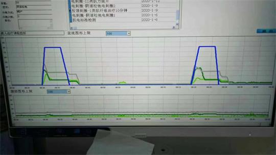 通泽子宫复旧治疗仪器，痛经不再是问题