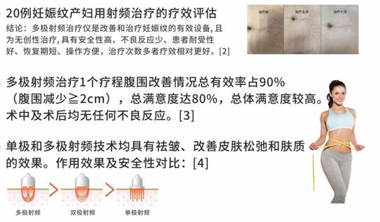 通泽产后塑形仪器，多极射频破解辣妈逆龄秘诀