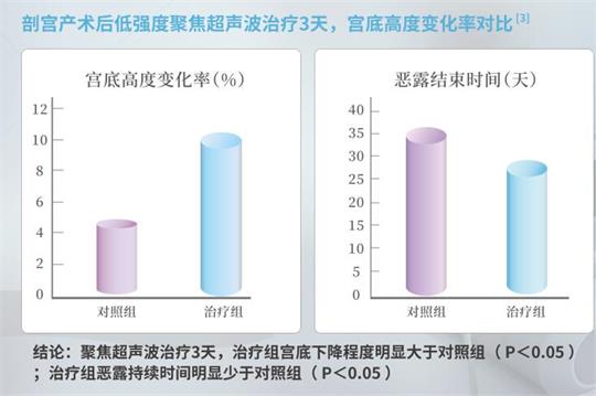 产后子宫修复仪器，重回少女身材