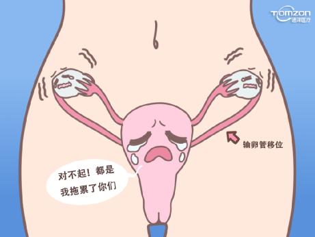 子宫下降可以用盆底肌修复仪器治疗