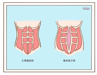 盆底康复治疗仪效果到底怎么样？