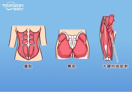 凯格尔运动该怎么做？盆底肌修复仪器还能用吗？