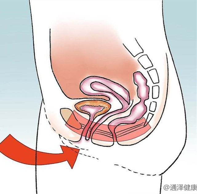 盆底治療儀