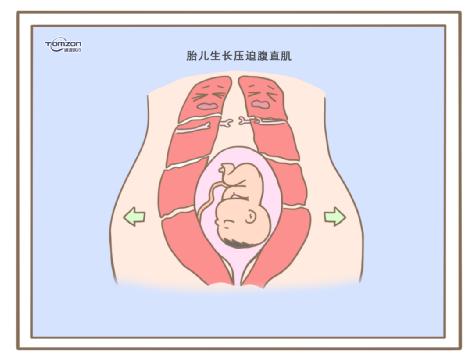 盆底肌修复仪器.jpg