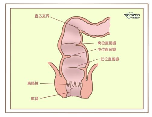 盆底肌修复仪器.jpg