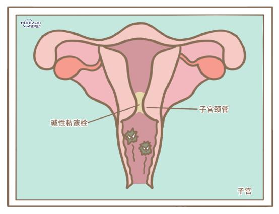 盆底康复治疗仪