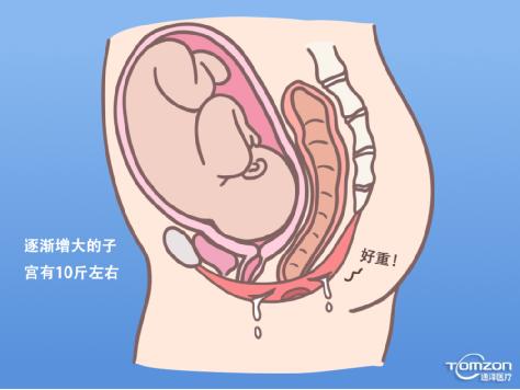 盆底康复治疗仪