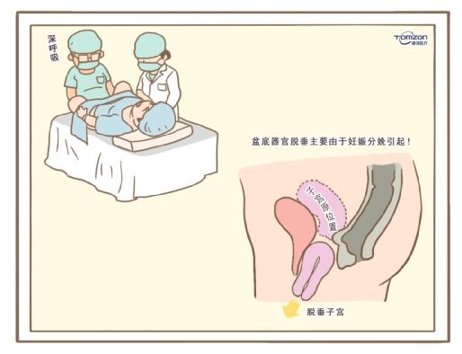 盆底康复治疗仪